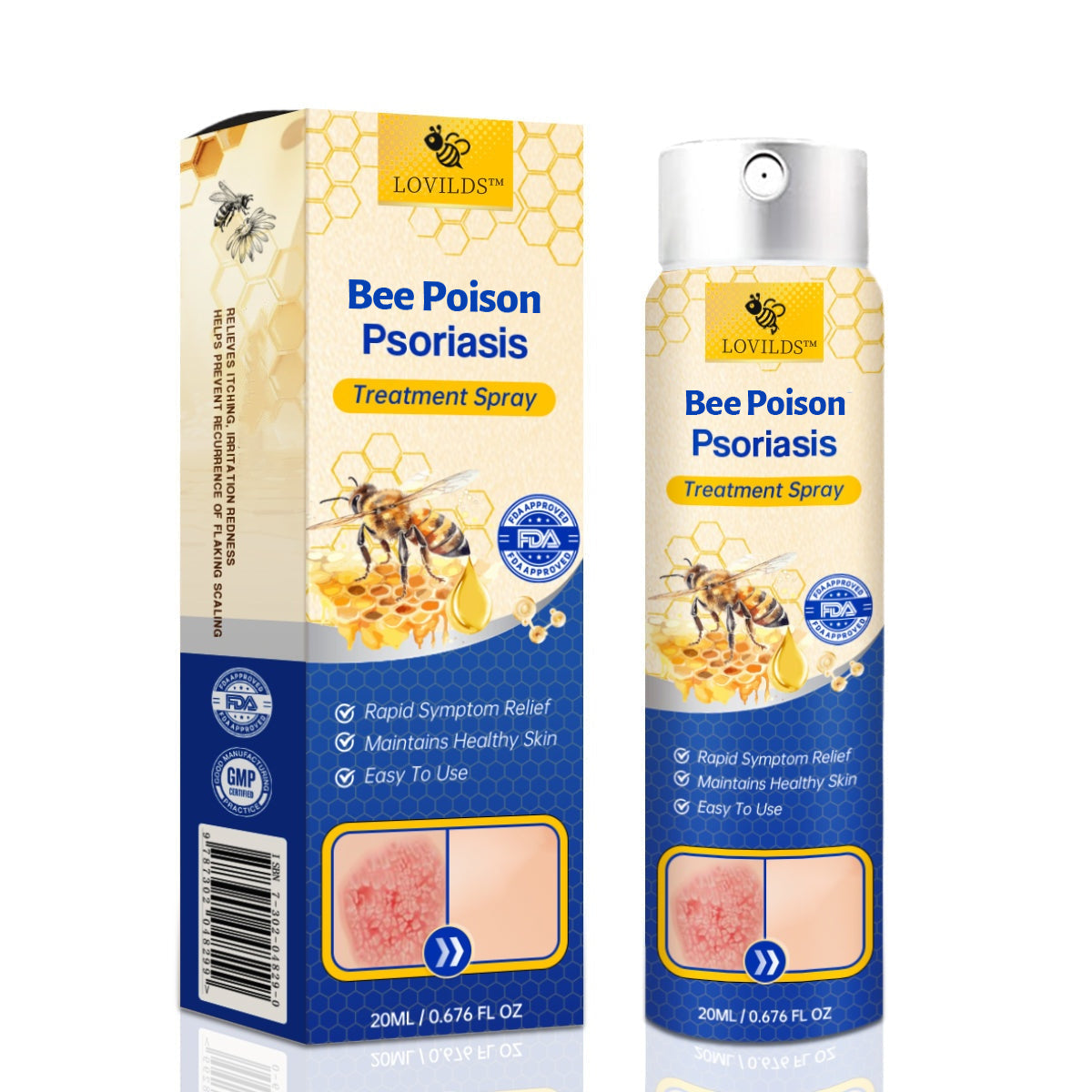 ❤️LOVILDS™ PsoriaHeal Bee poison Psoriasis Treatment Spray pro (Suitable for all skin conditions)