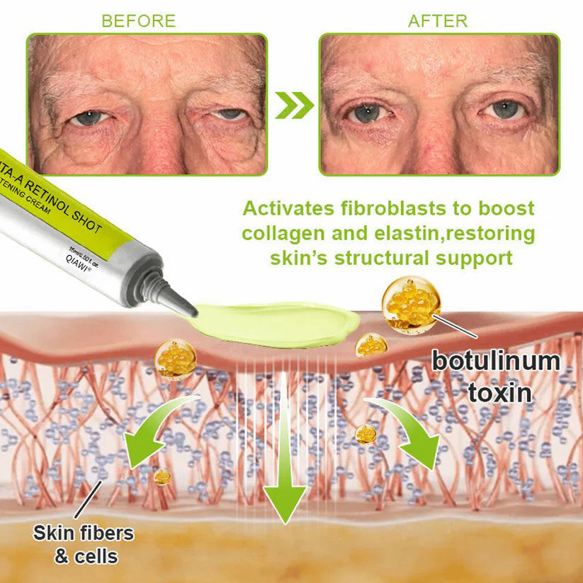 Final 3 Hours: 70%OFF🔥 QIAWI™ Botulinum & Vita-A Retinol Shot Wrinkle-Lift Tightening cream✨