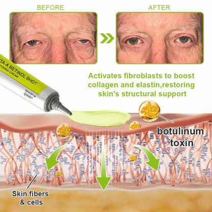 Final 3 Hours: 70%OFF🔥 QIAWI™ Botulinum & Vita-A Retinol Shot Wrinkle-Lift Tightening cream✨