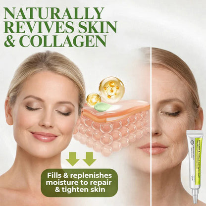 Final 3 Hours: 70%OFF🔥 QIAWI™ Botulinum & Vita-A Retinol Shot Wrinkle-Lift Tightening cream✨