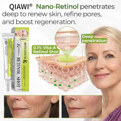 Final 3 Hours: 70%OFF🔥 QIAWI™ Botulinum & Vita-A Retinol Shot Wrinkle-Lift Tightening cream✨